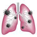 image for Doomscroll, showing lungs infected with a virus